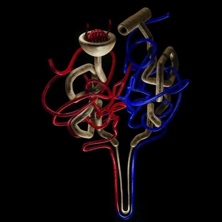 kidney-health-514707ccea364446a356bef3a306547d